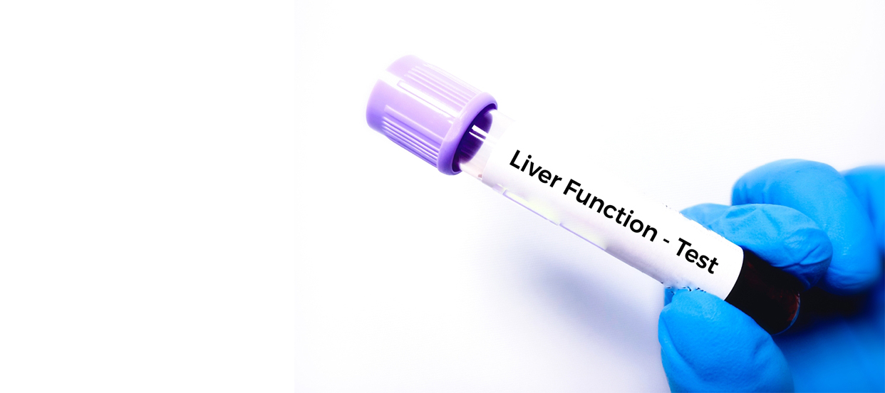 Liver Function Test (LFT) Normal Range: A Complete Guide